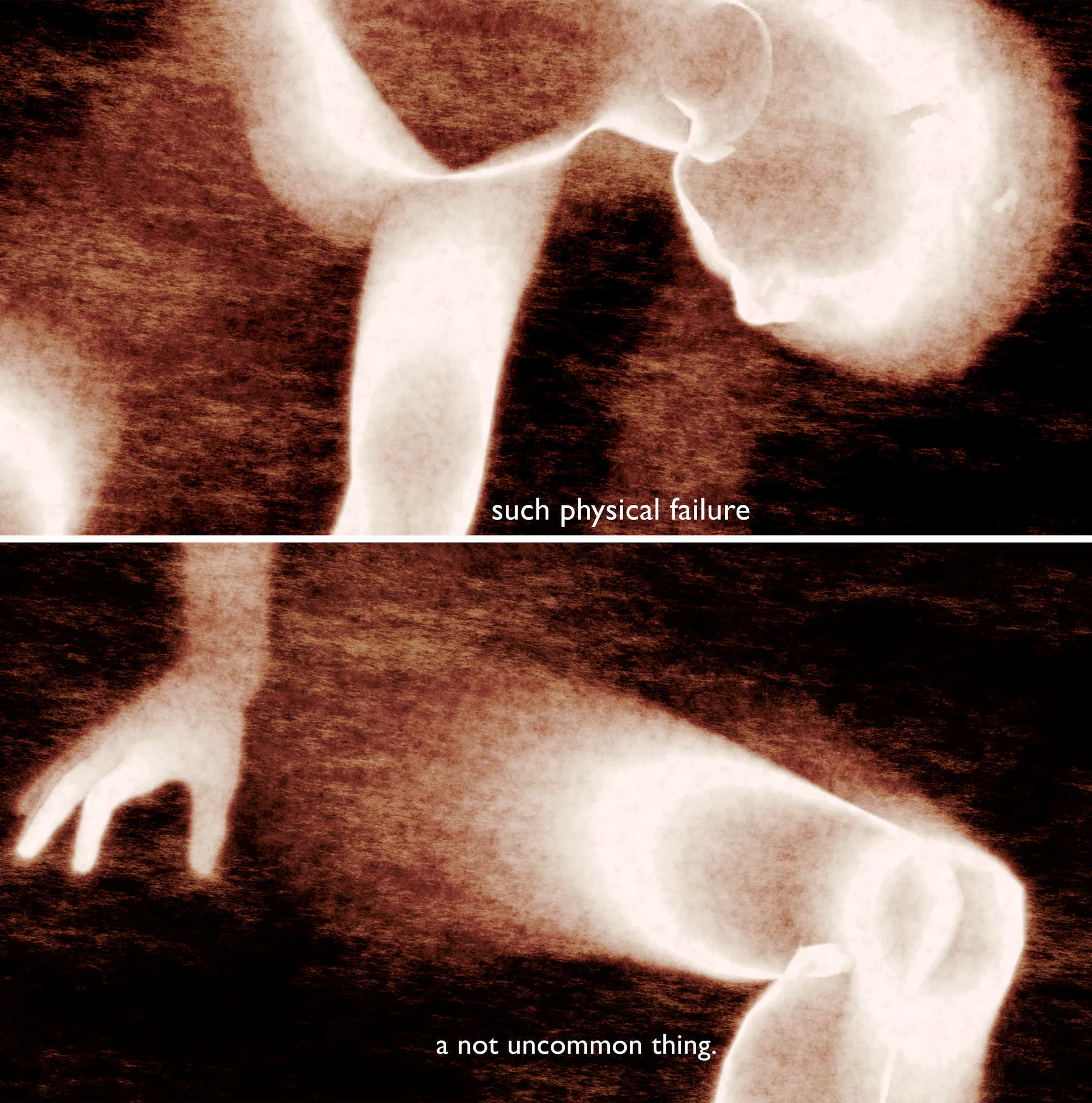 such physical failure / a not uncommon thing